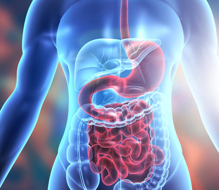 Femoral Hernia Image